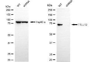 Western blotting analysis using TTLL12 antibody (ABIN7800661). (TTLL12 抗体)