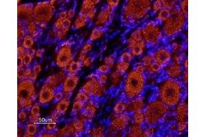 Expression of KCNK18 in rat dorsal root ganglia - Immunohistochemical staining of rat dorsal root ganglia (DRG) frozen sections using Anti-KCNK18 (TRESK) (extracellular) Antibody (ABIN7043446, ABIN7045021 and ABIN7045022), (1:100) followed by Alexa 555-labeled secondary antibody (red staining). (KCNK18 抗体  (Extracellular))