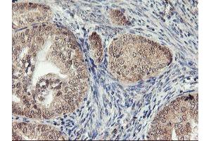 Image no. 2 for anti-1-Acylglycerol-3-Phosphate O-Acyltransferase 5 (Lysophosphatidic Acid Acyltransferase, Epsilon) (AGPAT5) antibody (ABIN1496498) (AGPAT5 抗体)
