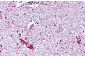 Anti-MRGPRF antibody  ABIN1049073 IHC staining of human brain, neurons and glia. (Mrgprf 抗体  (N-Term))