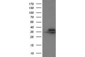 Western Blotting (WB) image for anti-Cyclin-Dependent Kinase 2 (CDK2) antibody (ABIN1497394) (CDK2 抗体)