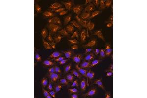 Immunofluorescence (IF) image for anti-Succinate Dehydrogenase Complex, Subunit B, Iron Sulfur (Ip) (SDHB) (AA 29-280) antibody (ABIN6147472)