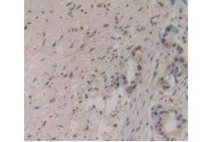 Immunohistochemistry (IHC) image for anti-Myostatin (MSTN) (AA 267-375) antibody (ABIN7427852)