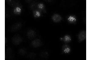Image no. 1 for anti-Centromere Protein E, 312kDa (CENPE) antibody (ABIN108562) (CENPE 抗体)