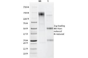 SDS-PAGE Analysis Purified Helicobacter pylori Mouse Monoclonal Antibody (HP/212). (Helicobacter Pylori 抗体)