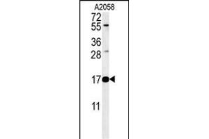 RNASEK Antibody (Center) &65288,Cat(ABIN651452 and ABIN2840246)&65289, western blot analysis in  cell line lysates (35 μg/lane). (Ribonuclease K 抗体  (AA 26-55))