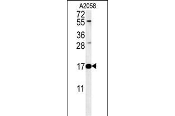 Ribonuclease K 抗体  (AA 26-55)
