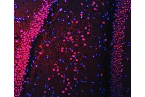 IF analysis of RBM22 using anti-RBM22 antibody (ABIN7600268).