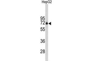 Western Blotting (WB) image for anti-F-Box Protein 3 (FBXO3) antibody (ABIN3004076) (F-Box Protein 3 抗体)