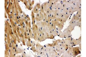 Immunohistochemistry (IHC) image for anti-G Protein-Coupled Receptor Kinase 5 (GRK5) (AA 393-429), (C-Term) antibody (ABIN3042434)