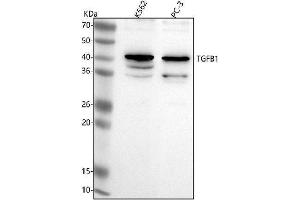 Western blot analysis of TGF Beta 1/TGFB1 using anti-TGF Beta 1/TGFB1 antibody (ABIN7601058).