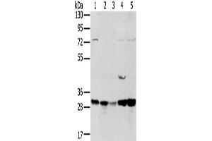 Western Blotting (WB) image for anti-Tumor Protein D52-Like 2 (TPD52L2) antibody (ABIN2434039) (TPD52L2 抗体)