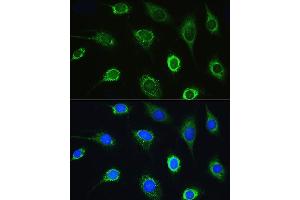 Immunofluorescence analysis of L929 cells using LARS Rabbit pAb (ABIN7268238) at dilution of 1:100. (LARS 抗体  (AA 1-270))