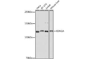 Western blot analysis of extracts of various cell lines, using KDM2A antibody (ABIN7268326) at 1:1000 dilution. (KDM2A 抗体)