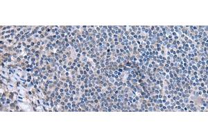 Immunohistochemistry of paraffin-embedded Human tonsil tissue using CCK Polyclonal Antibody at dilution of 1:55.