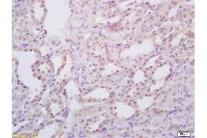 Formalin-fixed and paraffin embedded rat kidney labeled with Rabbit Anti StAR/StARD1 Polyclonal Antibody, Unconjugated (ABIN700960) at 1:200 followed by conjugation to the secondary antibody and DAB staining (STAR 抗体  (AA 101-200))