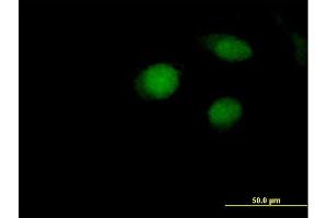 Immunofluorescence of purified MaxPab antibody to ARL4A on HeLa cell. (ARL4A 抗体  (AA 1-200))
