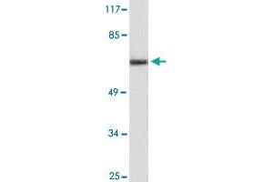 Western blot analysis of HUVEC cell lysate with CYP24A1 polyclonal antibody . (CYP24A1 抗体)