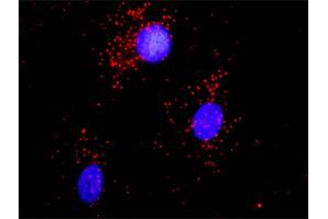 Proximity Ligation Analysis of protein-protein interactions between ACTN1 and CAMK2A. (CAMK2A 抗体  (AA 305-410))
