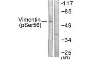 Western blot analysis of extracts from A549 cells treated with Nocodazole 1ug/ml 16h, using Vimentin (Phospho-Ser56) Antibody. (Vimentin 抗体  (pSer56))