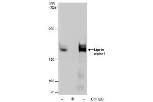 IP Image Immunoprecipitation of Liprin alpha 1 protein from A431 whole cell extracts using 5 μg of Liprin alpha 1 antibody [N1N2], N-term, Western blot analysis was performed using Liprin alpha 1 antibody [N1N2], N-term, EasyBlot anti-Rabbit IgG  was used as a secondary reagent. (PPFIA1 抗体  (N-Term))