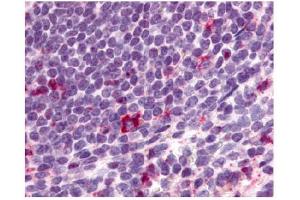 Immunohistochemical staining of spleen lymphocytes using antibody ABIN122022 (CCR2 抗体)