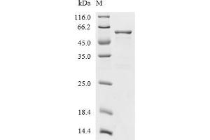 (Tris-Glycine gel) Discontinuous SDS-PAGE (reduced) with 5 % enrichment gel and 15 % separation gel.