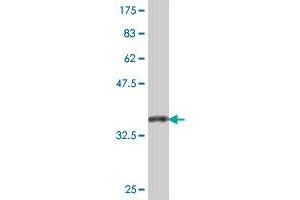 Western Blot detection against Immunogen (36. (IDH2 抗体  (AA 354-451))