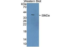 Western blot analysis of the recombinant protein. (PDE12 抗体  (AA 290-602))