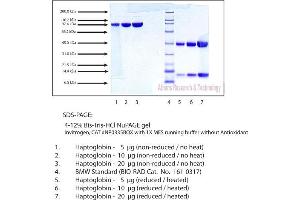 Gel Scan of Haptoglobin, Phenotype 1-1, Human Plasma  This information is representative of the product ART prepares, but is not lot specific. (Haptoglobin Protein (HP) (Phenotype 1-1))