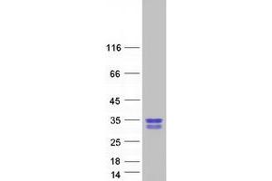 Western Blotting (WB) image for GAR1 Ribonucleoprotein Homolog (Yeast) (GAR1) (Transcript Variant 2) protein (Myc-DYKDDDDK Tag) (ABIN2727450)