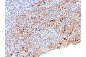 Immunohistochemistry (IHC) image for anti-Hepatitis A Virus Cellular Receptor 2 (TIM 3) (AA 22-202) antibody (ABIN6940963)