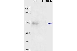 Lane 1: human colon carcinoma lysates Lane 2: mouse embryo lysates probed with Anti AVPR2 Polyclonal Antibody, Unconjugated (ABIN1386214) at 1:200 in 4 °C. (GDF9 抗体  (AA 301-400))
