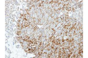 IHC-P Image Immunohistochemical analysis of paraffin-embedded Hep3B xenograft, using RRAS, antibody at 1:100 dilution. (R-Ras 抗体  (Center))
