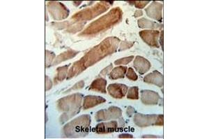 Immunohistochemistry (Paraffin-embedded Sections) (IHC (p)) image for anti-Methylmalonic Aciduria (Cobalamin Deficiency) Type A (MMAA) (AA 56-84), (N-Term) antibody (ABIN653752)