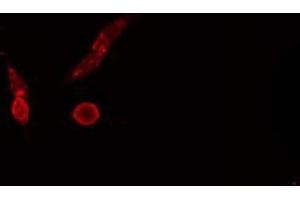 ABIN6274694 staining NIH-3T3 cells by IF/ICC. (Mre11 抗体  (C-Term))