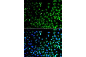 Immunofluorescence analysis of A549 cell using LHX6 antibody. (LHX6 抗体)
