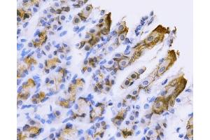 IHC analysis of Tspan-8/Tspan8 using anti-Tspan-8/Tspan8 antibody (ABIN7599681). (Tspan-8 抗体  (AA 108-203))