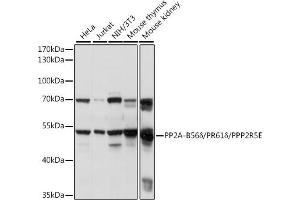 Western blot analysis of extracts of various cell lines, using PP2A-B56δ/PR61δ/PPP2R5E antibody (ABIN7269691) at 1:1000 dilution.