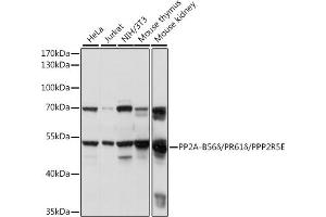Western blot analysis of extracts of various cell lines, using PP2A-B56δ/PR61δ/PPP2R5E antibody (ABIN7269691) at 1:1000 dilution. (PPP2R5E 抗体  (AA 398-467))