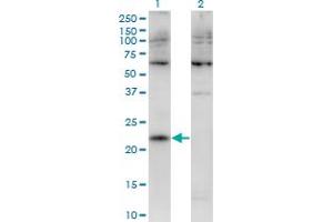 Western Blot analysis of CMTM4 expression in transfected 293T cell line by CMTM4 monoclonal antibody (M02), clone 1B9. (CMTM4 抗体  (AA 173-234))