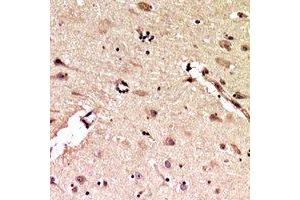 Immunohistochemical analysis of ALB staining in human brain formalin fixed paraffin embedded tissue section. (Albumin 抗体  (C-Term))