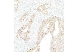 Immunohistochemistry (IHC) image for anti-Met Proto-Oncogene (MET) (C-Term) antibody (ABIN7795683) (Recombinant c-MET 抗体  (C-Term))