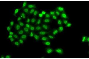 Immunofluorescence analysis of A549 cells using PHF11 Polyclonal Antibody (PHF11 抗体)