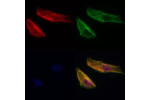 ABIN7093792 and ABIN7097835 staining Hela cells by IF/ICC. (PDLIM3 抗体  (Internal Region))