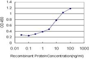 Detection limit for recombinant GST tagged PLEC1 is approximately 0. (PLEC 抗体  (AA 4384-4493))