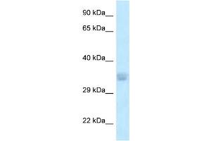 WB Suggested Anti-ACOT8 Antibody Titration: 1. (ACOT8 抗体  (N-Term))