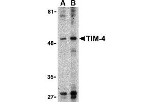 Western Blotting (WB) image for anti-T-Cell Immunoglobulin and Mucin Domain Containing 4 (TIMD4) (Middle Region) antibody (ABIN1031125) (TIMD4 抗体  (Middle Region))