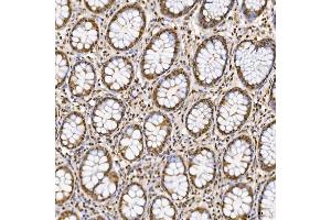 IHC analysis of SNRNP27 using anti-SNRNP27 antibody (ABIN7599614).