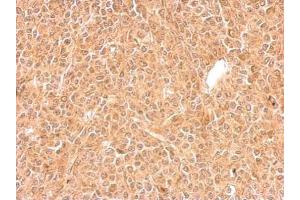 IHC-P Image GGPS1 antibody detects GGPS1 protein at cytosol on BT483 xenograft by immunohistochemical analysis. (GGPS1 抗体)